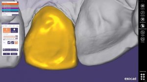 Моделирование одиночной коронки(создание зеркальной копии) + создание мастер-модели в Exocad