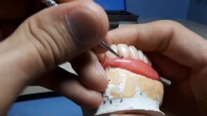 моделировка десны