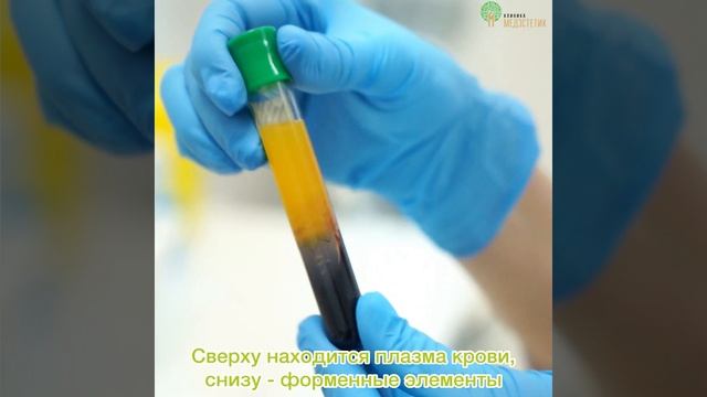 Плазмолифтинг