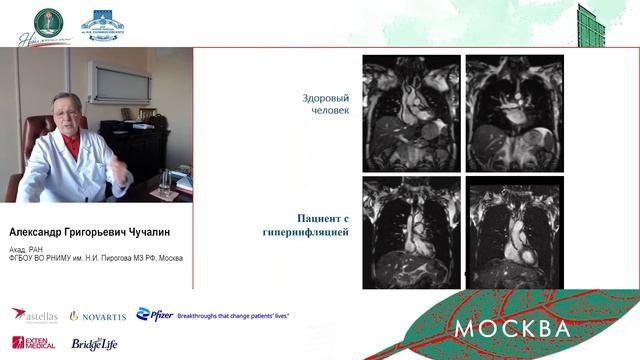 D1. Трансплантация лёгких