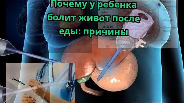 Почему у ребенка болит живот после еды: причины смотреть онлайн