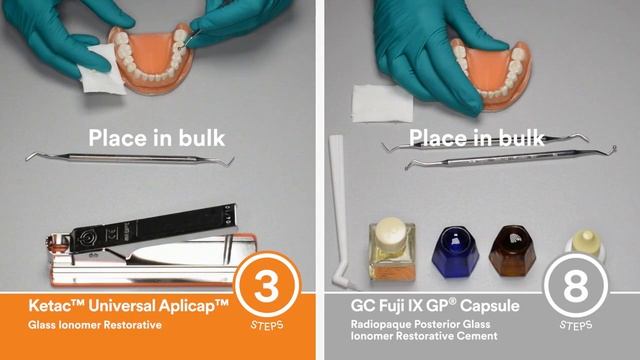 3M Ketac Universal Aplicap Technique, Global/NA смотреть онлайн