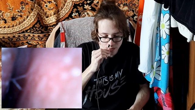 ЭНДОСКОП показывает мои внутренности (18+) смотреть онлайн