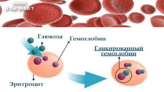 Признаки преддиабета – почему их нельзя игнорировать и как определить ... смотреть онлайн
