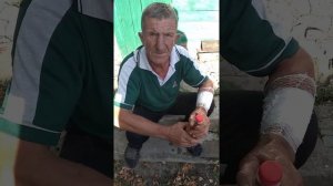 головень на перевязке