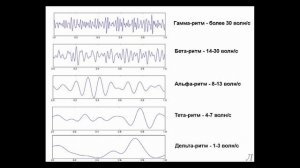3.15 Параметры нервной системы. Ритмы ЭЭГ