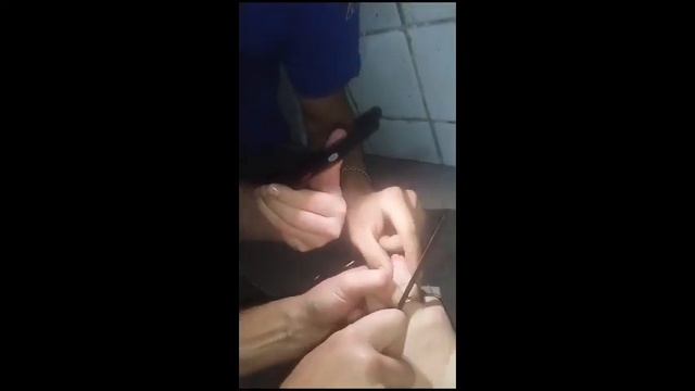 Пожарные 5 ПСЧ спасли палец женщине. смотреть онлайн