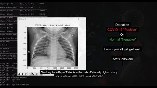 COVID 19 Detection - X-Ray & CT - Model 1 смотреть онлайн