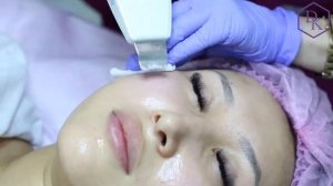 Ультразвуковая чистка лица + алмазная микродермабразия