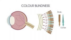 Eye and four vision problems | Physiology | Biology | FuseSchool