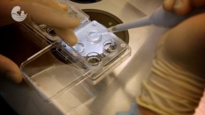 Лечение бесплодия: оплодотворение яйцеклетки