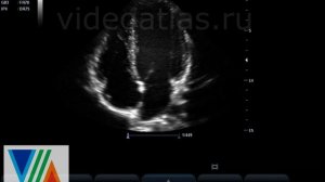 Сеть Киари (Хиари)