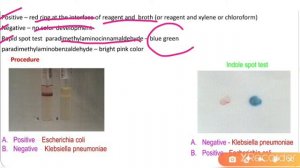 Pure Culture: 4|Indole & DNase test|M.Sc|GATE|ICAR-NET|CSIR-NET|Microbiology|Rohit Shankar Mane