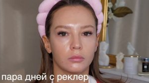 ЛУЧШИЕ И ХУДШИЕ ГАДЖЕТЫ ДЛЯ ЛИЦА