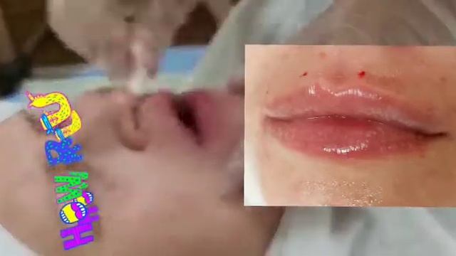 ТП губы, губы бантиком. смотреть онлайн