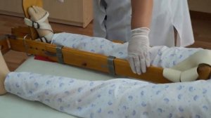 Транспортная иммобилизация при закрытых переломах нижних конечностей (перелом бедренной кости)