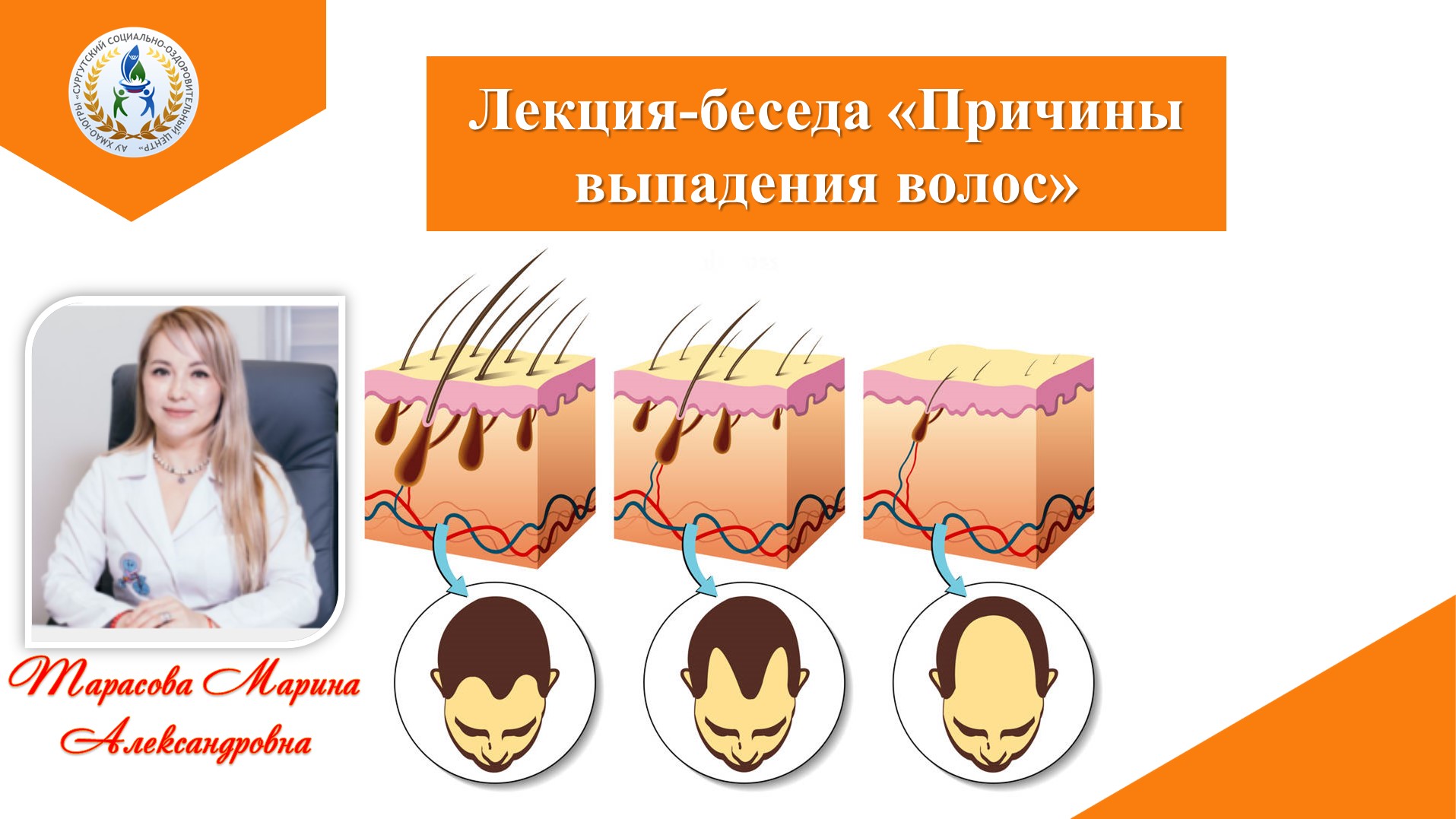 Отчего выпадает. Причины выпадения волос у женщин. Тест на выпадение волос. Гинекологические причины выпадения волос. Тест на выпадение волос у женщин.