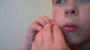 Прокол Щеки