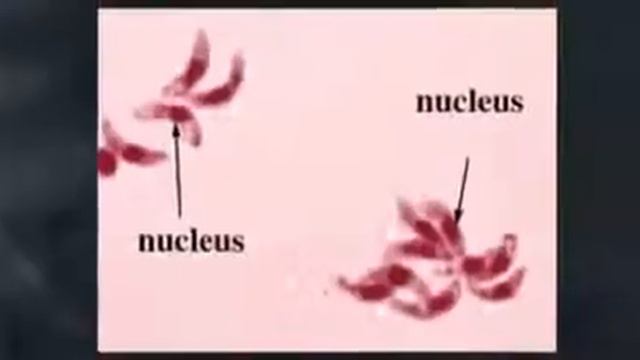 toxoplasma gondii смотреть онлайн