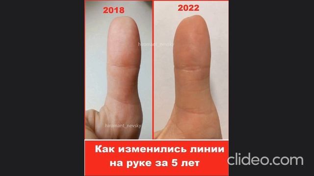 Как изменились линии за 5 лет? смотреть онлайн