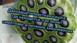 Двенадцатиперстная кишка: где находится, как болит, симптомы и лечение заболевания