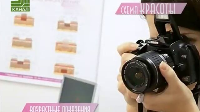 Схема красоты нитевая подтяжка лица 2
