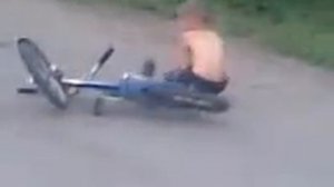 Открытый перелом, упал с велика