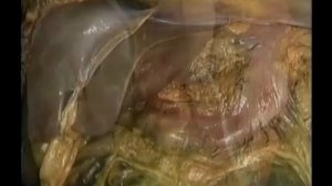 Vol 6 Анатомия Акланда - внутренние органы