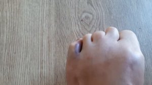 Как отличить ПЕРЕЛОМ МИЗИНЦА ОТ УШИБА