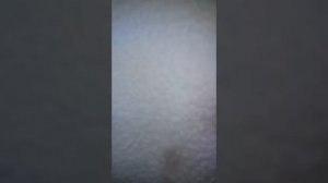 Течёт кровь из рта