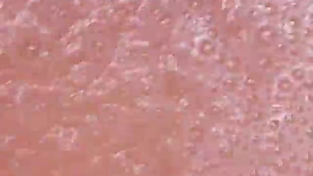 Elizavecca Enzyme powder microscope shooting / 엘리자베카 엔자임 파우더 현미경 촬영 смотреть онлайн
