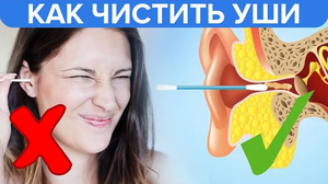 Как правильно чистить уши | Правильная гигиена ушей! - Доктор 24