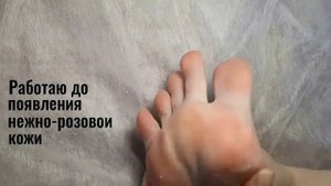 Обработка СТОПЫ МАНИКЮРНОЙ пилкой/ПЕДИКЮР СЕБЕ/ПОДРОБНО/Убираю НАТОПТЫШИ