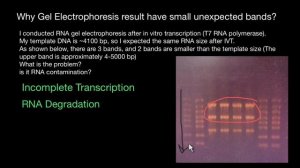 Why RNA Gel Electrophoresis result have small unexpected bands?