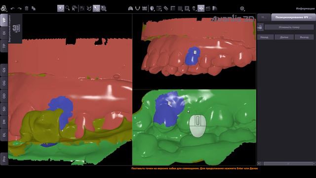 Новые возможности Avantis 3D.  Программирование виртуального артикулятора.