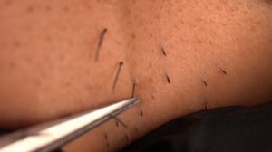 Вытяните нежелательные волосы щетиной с помощью пинцета【Удаление волос принцесс 20210427】