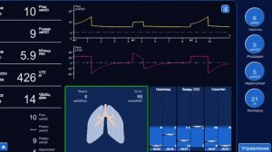 Симуляция ИВЛ на персональномкомпьютере Горячев А.С