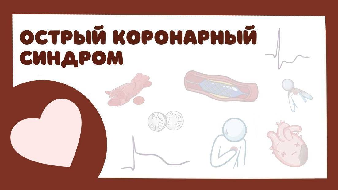 ОКС Острый Коронарный Синдром - тактика ведения, лечение (лекция) инфаркт