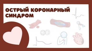 ОКС Острый Коронарный Синдром - тактика ведения, лечение (лекция) инфаркт