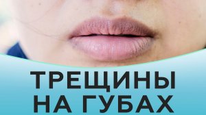 Трещины на губах. Как избавиться от трещин на губах.
