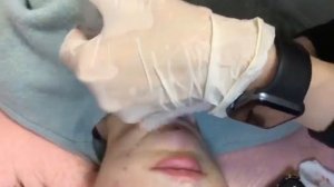 Липолитики - убираем второй подбородок