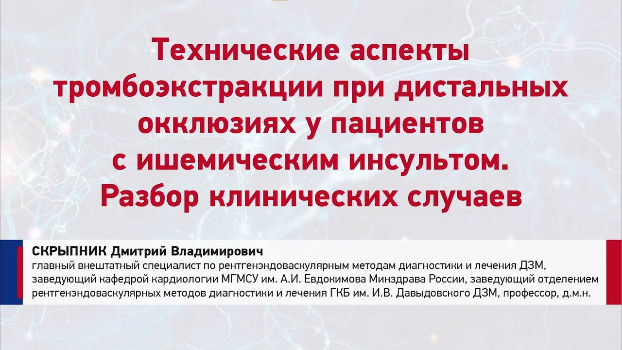 Тромболизис при ишемическом инсульте. Эндоваскулярное лечение ишемического инсульта. Эндоваскулярная тромбэкстракция. Тромбоэкстракция противопоказания. Тромбоэкстракция при ишемическом инсульте.
