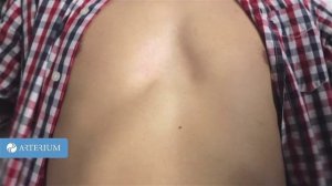 Первая помощь при остановке сердца