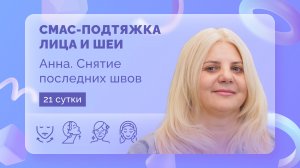 СМАС-подтяжка лица и шеи. Анна. 21 сутки после операции