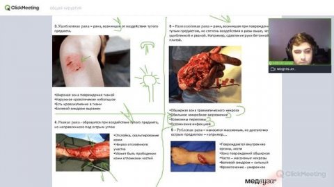 Раны | Признаки ран | Классификация ран | Особенности огнестрельных ран | Общая хирургия