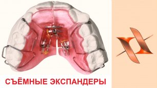 Съемные ортодонтические аппараты для расширения.
