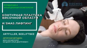 Профилактика старения! Контурная пластика височной области и smas лифтинг за один сеанс.  #доипосле