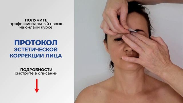 Межбровные морщины. Аппликация тейпами
