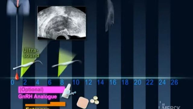 криопротокол смотреть онлайн