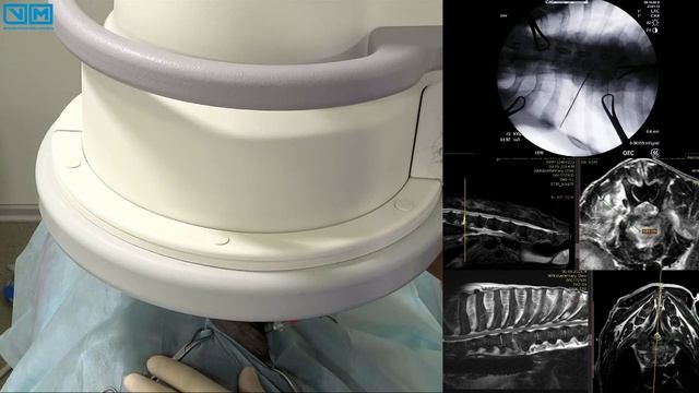 Забор бакпосева при дискоспондилите у овчарки. смотреть онлайн